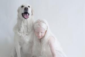 Люди-альбиносы: как выглядят и где живут, опасен ли альбинизм?